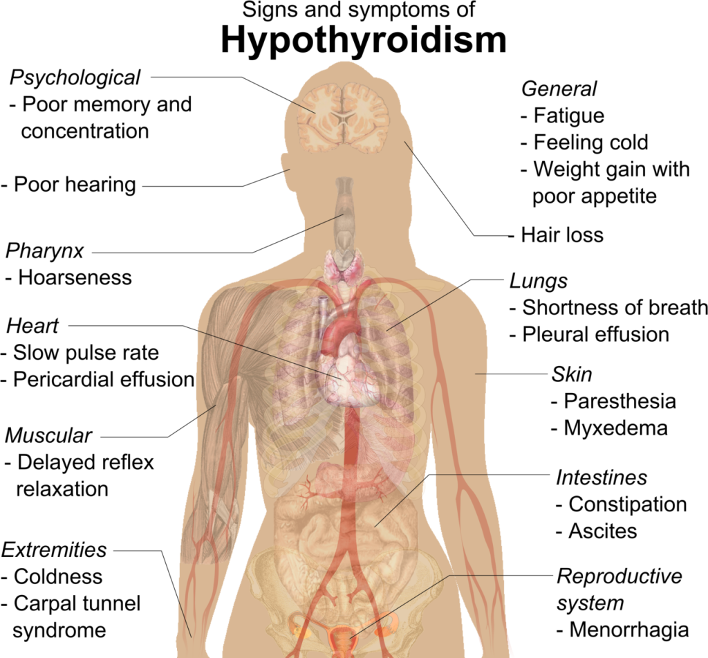 Signs and symptoms of hypothyroidism
